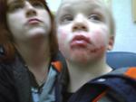face_bite1